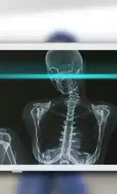 透视镜