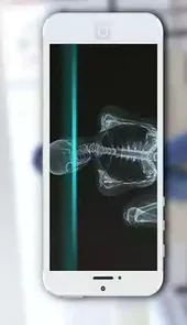ct透视仪