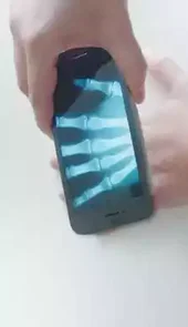 ct透视仪