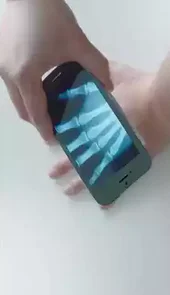 ct透视仪