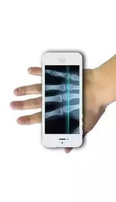 ct透视仪